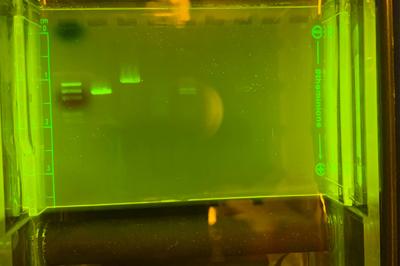 Gel electrophoresis showing DNA ladder and several DNA bands